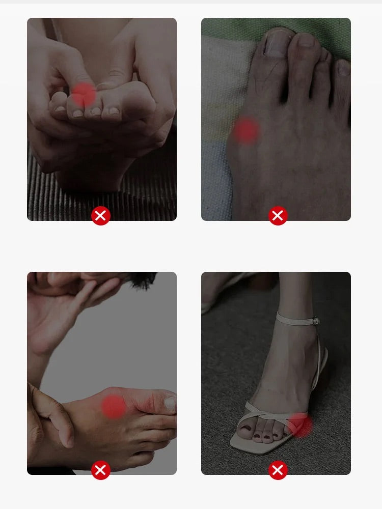 Par de Meias Ortopédicas para Joanete